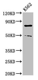 IHC-plus™ PAD2 / PADI2 Antibody (aa1-665)