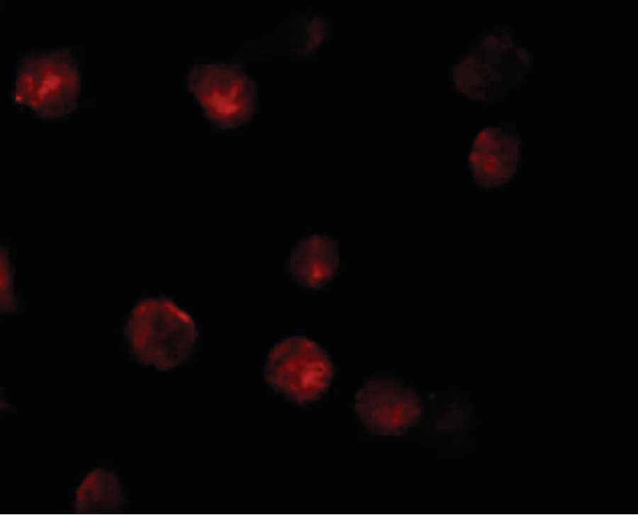 ZMIZ1 Antibody