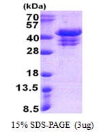 Human UFD1L Protein (Recombinant His)