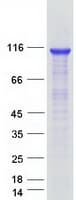 Human DIS3 Protein (Recombinant Myc-DDK (Flag))