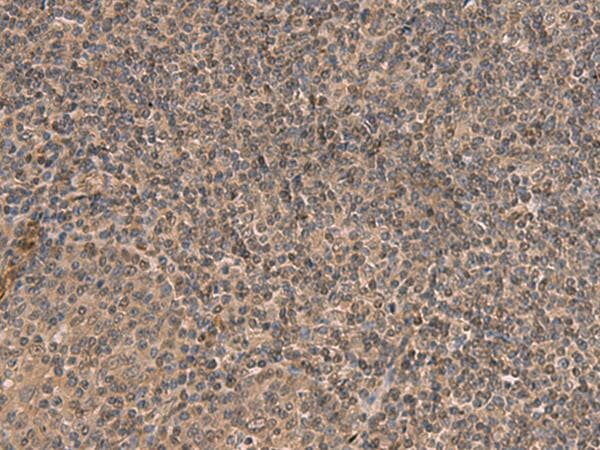 HEBP2 Antibody