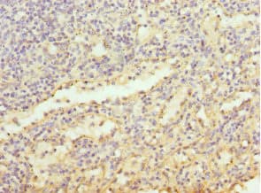 Polyclonal Rabbit anti-Human MD-1 / LY86 Antibody (IHC)