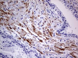 AFAP1 / AFAP Antibody (aa100-386, clone OTI2G9)