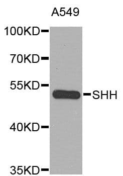 SHH / Sonic Hedgehog Antibody
