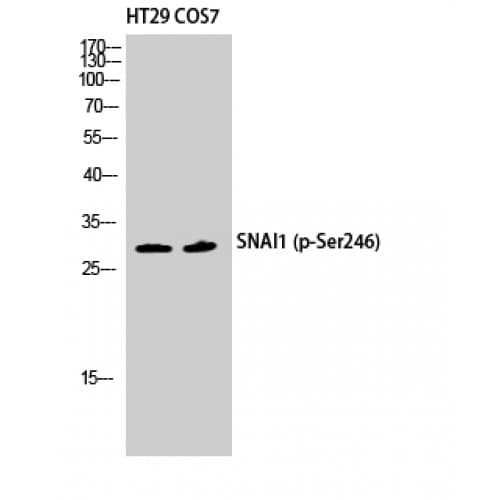 SNAI1 / SNAIL-1 Antibody (190-270 aa)