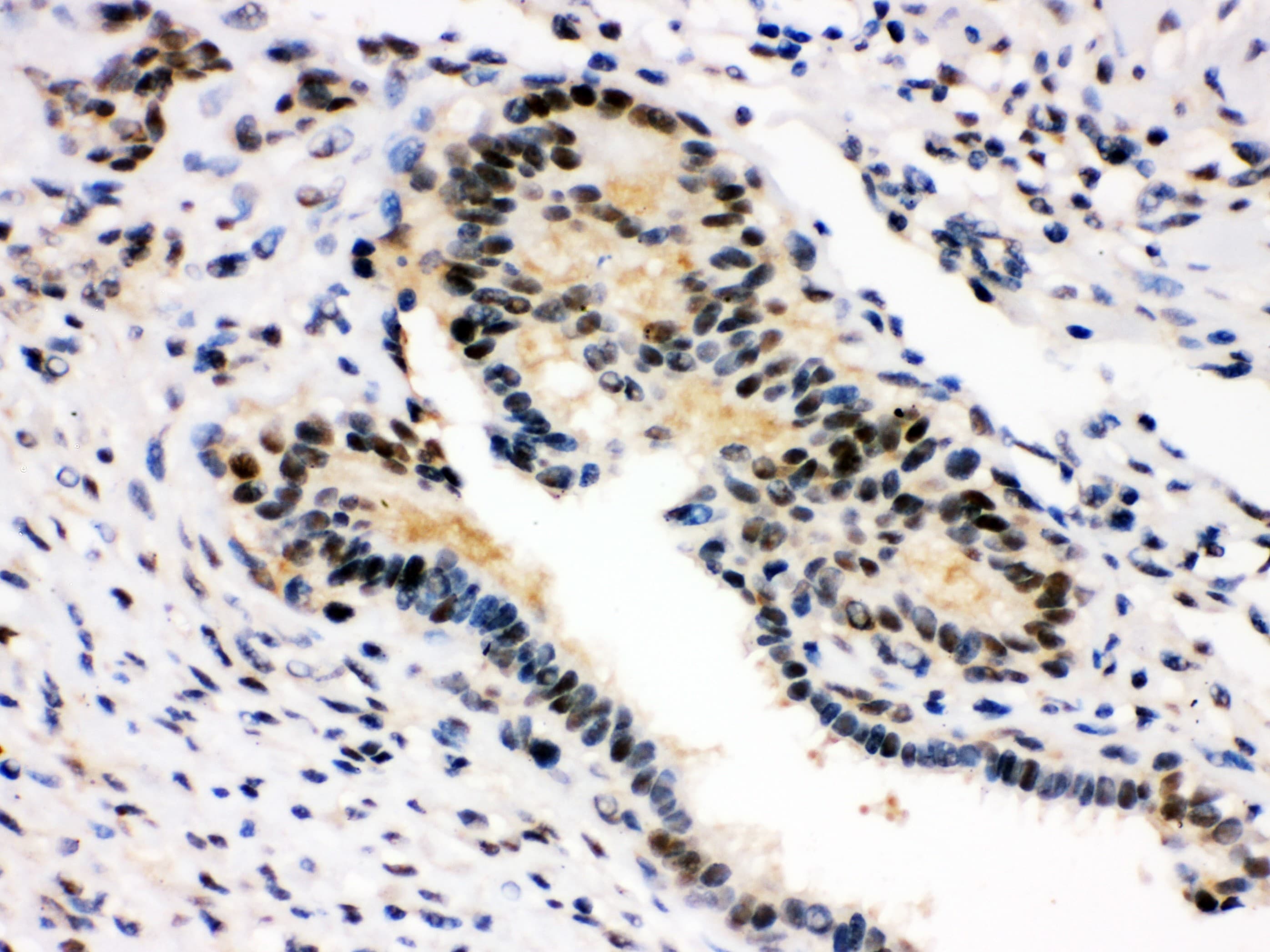 SMN1 Antibody (aa22-52)