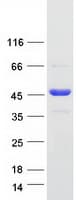 Human CCDC94 Protein (Recombinant Myc-DDK (Flag))
