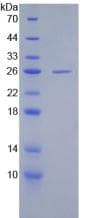 Human cPLA2 Protein (Recombinant His)