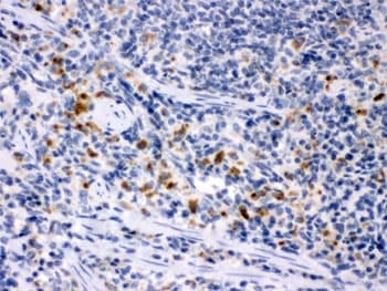 CSF1 / MCSF Antibody