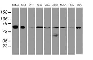 IHC-plus™ UQCRC1 Antibody (clone 1G6)