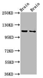 CLIP2 / CYLN2 Antibody