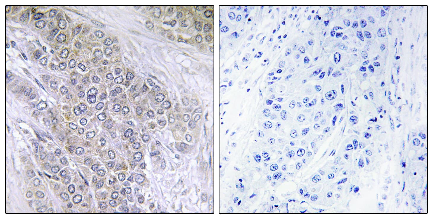 BCL2 / Bcl-2 Antibody (phospho-Thr56)