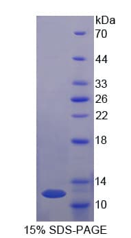 Rat VWF / Von Willebrand Factor Protein (Recombinant His)