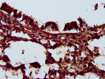 Polyclonal Rabbit anti-Human KLK14 / Kallikrein 14 Antibody (IHC)