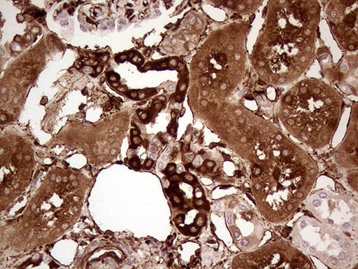 TGM2 / Transglutaminase 2 Antibody (clone OTI2F9, Carrier-free)