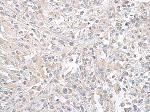 FXYD6 Antibody