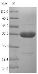 Serratia marcescens hasA Protein (Recombinant 6His-SUMO, N-terminus)