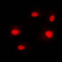 HNRPM / HNRNPM Antibody (N-Terminus)
