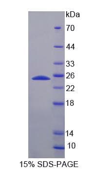 Human FDXR Protein (Recombinant His, N-Terminal)