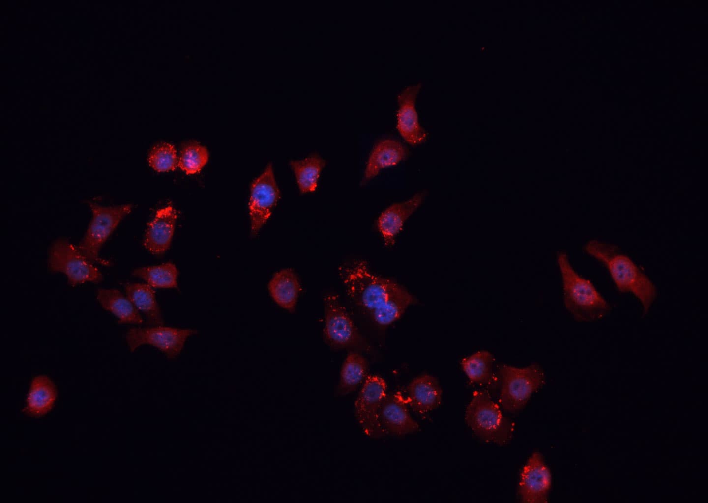 FHIT Antibody
