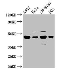 Polyclonal Rabbit anti-Human LYAR Antibody (IHC, WB)