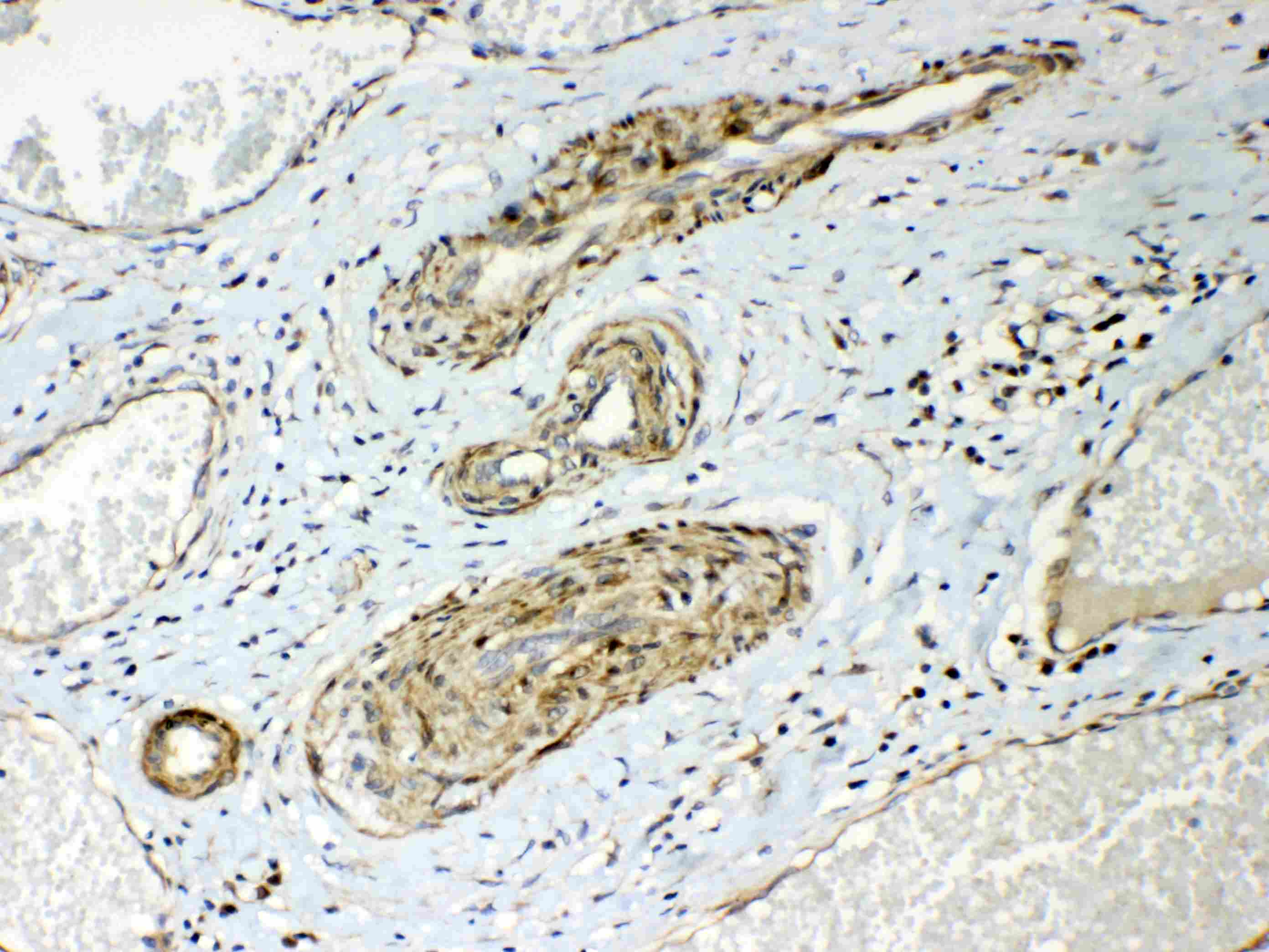 HSPB8 / H11 / HSP22 Antibody