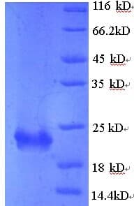 Bordetella pertussis fim2 / Fimbrial Subunit Protein (Recombinant 6His, N-terminus)