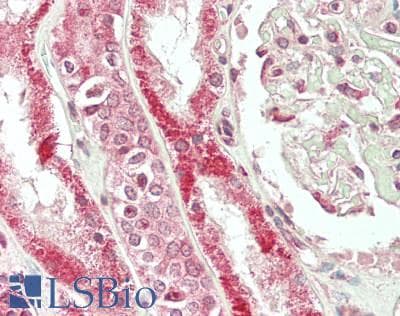 IHC-plus™ CDK13 / CDC2L5 Antibody