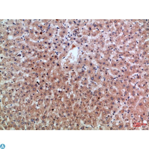 Polyclonal Rabbit anti-Human EREG / Epiregulin Antibody (WB)