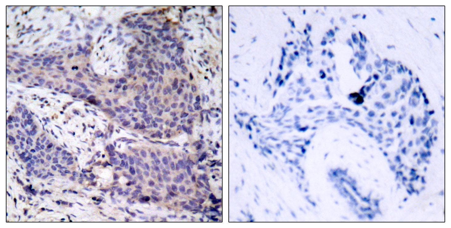 Polyclonal Rabbit anti-Human BAD Antibody (p136, IHC, WB)