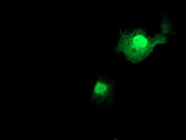FXN / Frataxin Antibody (clone OTI3C3)