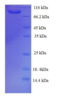 Human GCC1 / GCC88 Protein (Recombinant His-SUMO)