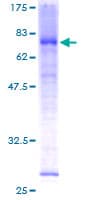 Human MAK Protein (Recombinant GST)