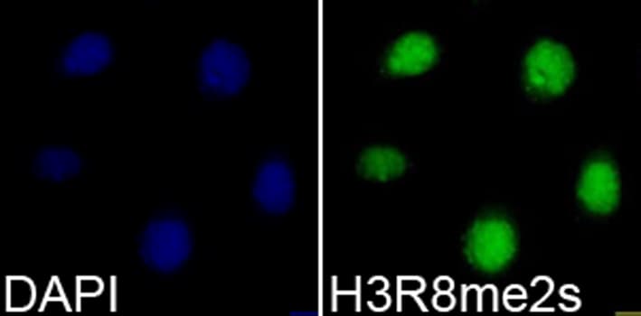 Polyclonal Rabbit anti-Human Histone H3 Antibody (Sym-Di-Methyl-Arg8, IHC, IF, WB)