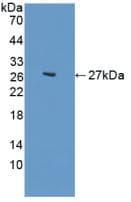 CDH2 / N Cadherin Antibody (aa50-276)