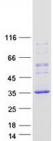 Human REP15 Protein (Recombinant Myc-DDK (Flag))