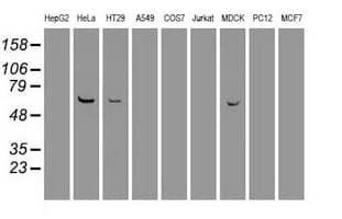 PLK1 / PLK-1 Antibody (clone OTI6C6)