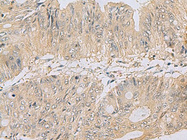 TSTA3 / GDP-L-Fucose Synthase Antibody