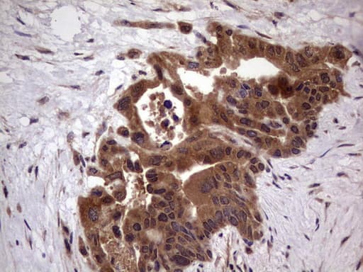 Monoclonal Mouse anti-Human BFSP2 Antibody (clone OTI4E7, aa184-415, IHC, WB)