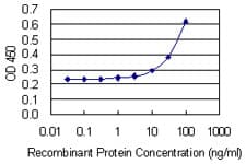 CRYBB2 Antibody (clone 1F1)