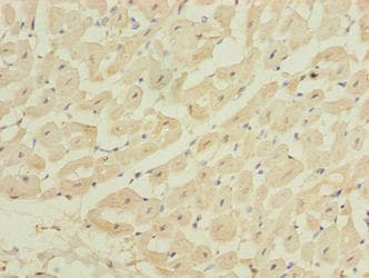 Polyclonal Rabbit anti-Human ZBTB6 Antibody (IHC, WB)