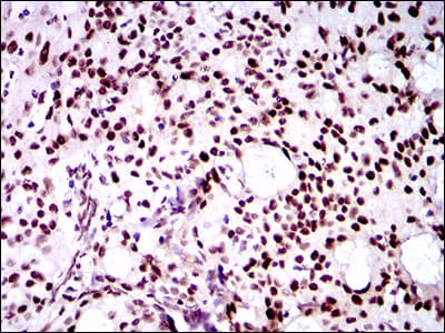 Monoclonal Mouse anti-Human TWIST1 / TWIST Antibody (clone 10E4E6, aa9-74, IHC, IF, WB)