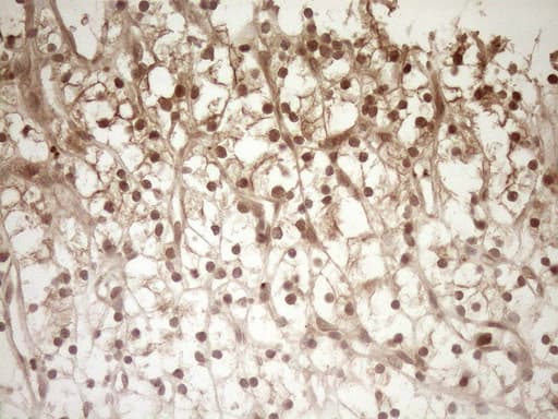 Monoclonal Mouse anti-Human HGF / Hepatocyte Growth Factor Antibody (clone OTI1E5, aa200-494, IHC)