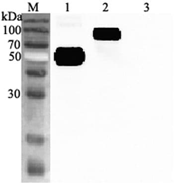 IL1RL1 Antibody