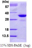 Human TNFSF5IP1 / CLAST3 Protein (Recombinant His)