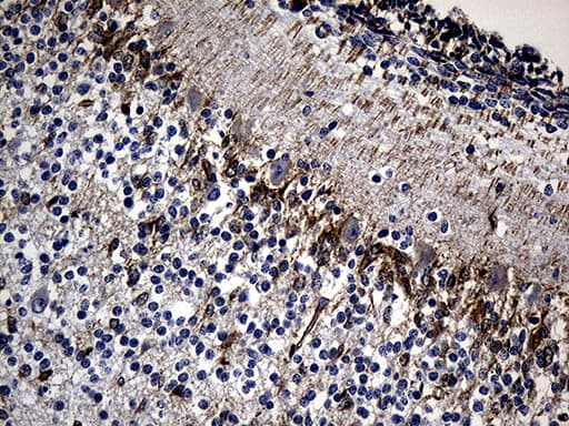 Monoclonal Mouse anti-Human NES / Nestin Antibody (clone OTI3B12, aa99-349, IHC, WB)