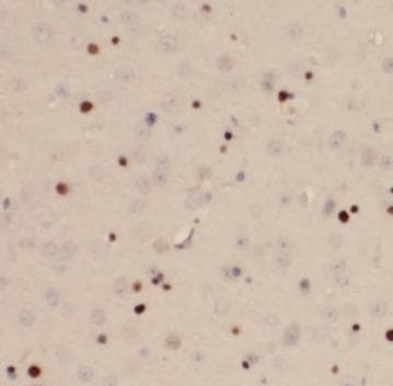 FOS / c-FOS Antibody