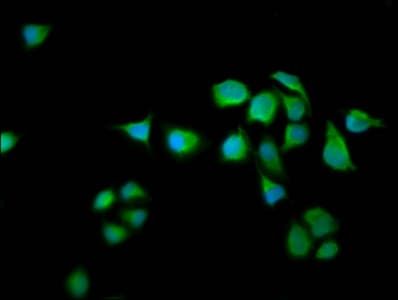 Polyclonal Rabbit anti-Human NGAP / RASAL2 Antibody (IHC, IF)