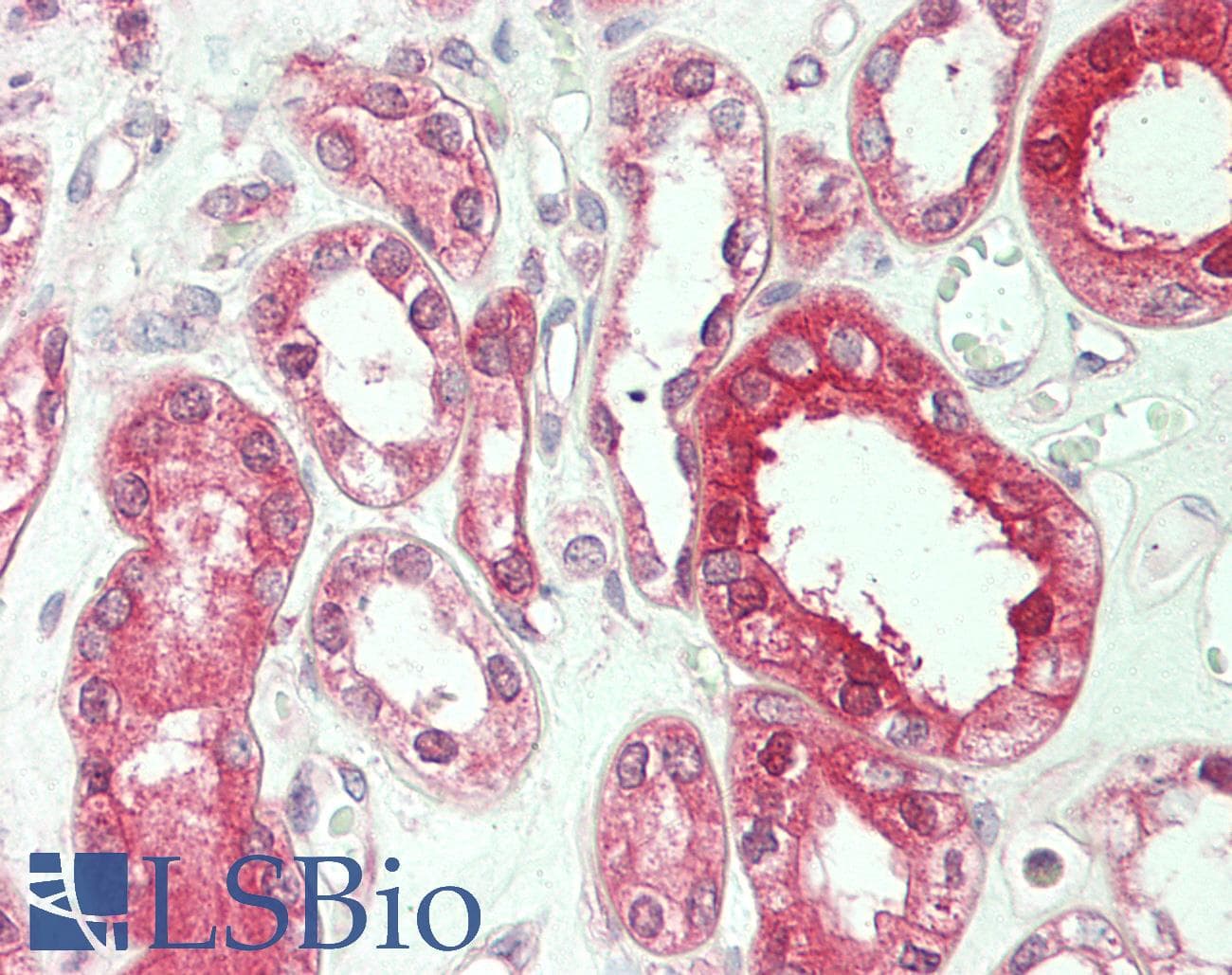 IHC-plus™ SYK Antibody (aa5-360, clone SYK-01)
