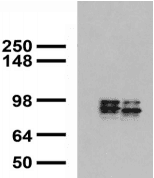 MMP9 / Gelatinase B Antibody (clone S51-82)